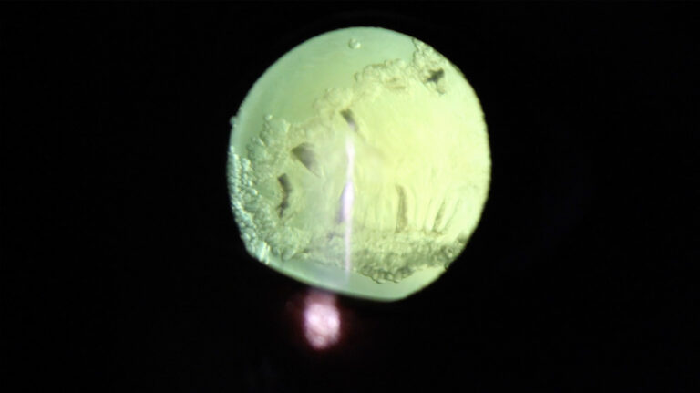 A microscopic view of the inside of an eye, a green textured surface appears surrounded by a deep black background