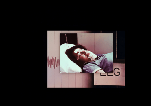 This is a still from the film 'Music for Solo Performer'(2022) by Jenny Brady. The image consists of two overlayed pictures, set against a large black background. In the front image, there is a woman undergoing EEG analysis. She is lying sideways on a white pillow, wearing a blue top. The woman has dark hair, light skin, and her eyes are closed. Various attachments secured with tape can be seen across her chin, temples, and forehead, with wires coming out of them. To the right of the frame, there is a cream-coloured wall, while to the left of the frame, there is a black area behind her. In the underlay image, there is another section of the same type of wall, displaying large red EEG analysis waves across its centre. At the bottom right corner of the frame, there is partially visible text in large black print that reads "EEG", with a dark area above it. The overall image has a vintage quality and colouring.